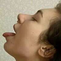 acidmelanie Nøgen