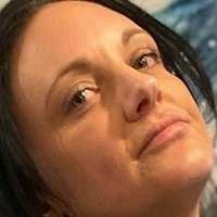 amputeedarling Nøgen