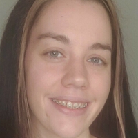 bracefacefree Nøgen