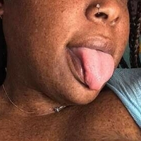 freckledfantasy5 Nøgen