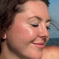 gingerfreckles Nøgen