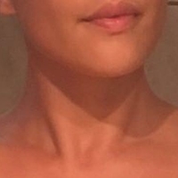 Laura Ortega Nøgen