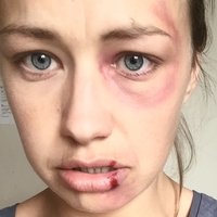 Lorna Dempsey Nøgen