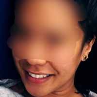 Monica X. Torress Nøgen