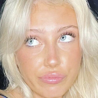 Notkayyybaby Nøgen