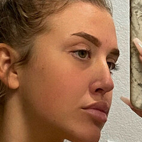 Rochelllle Nøgen