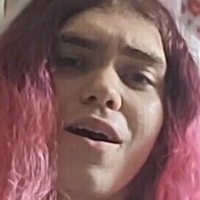 roseyccomplexion Nøgen