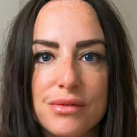 scarred4life3 Nøgen