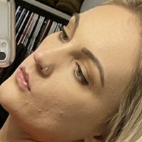 xoxalexis Nøgen
