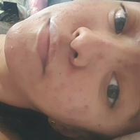 xsugarvulpesx Nøgen